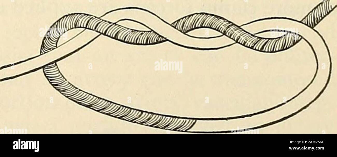 Necrosis arm hires stock photography and images Alamy