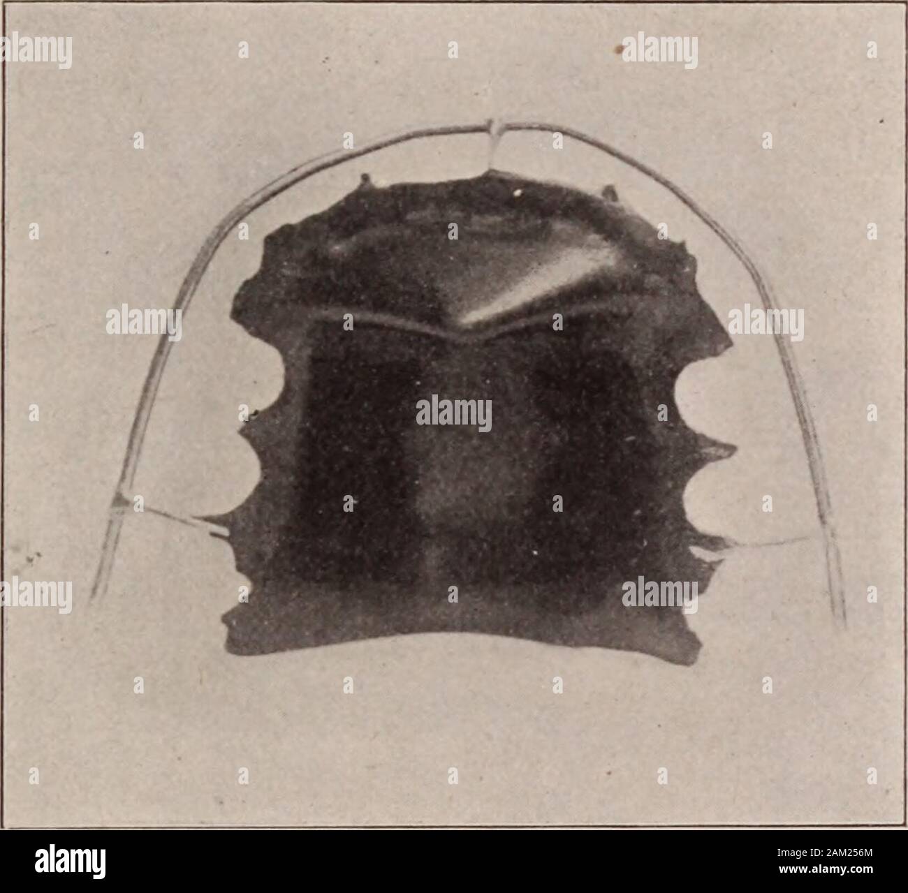 Dental arches hires stock photography and images Alamy