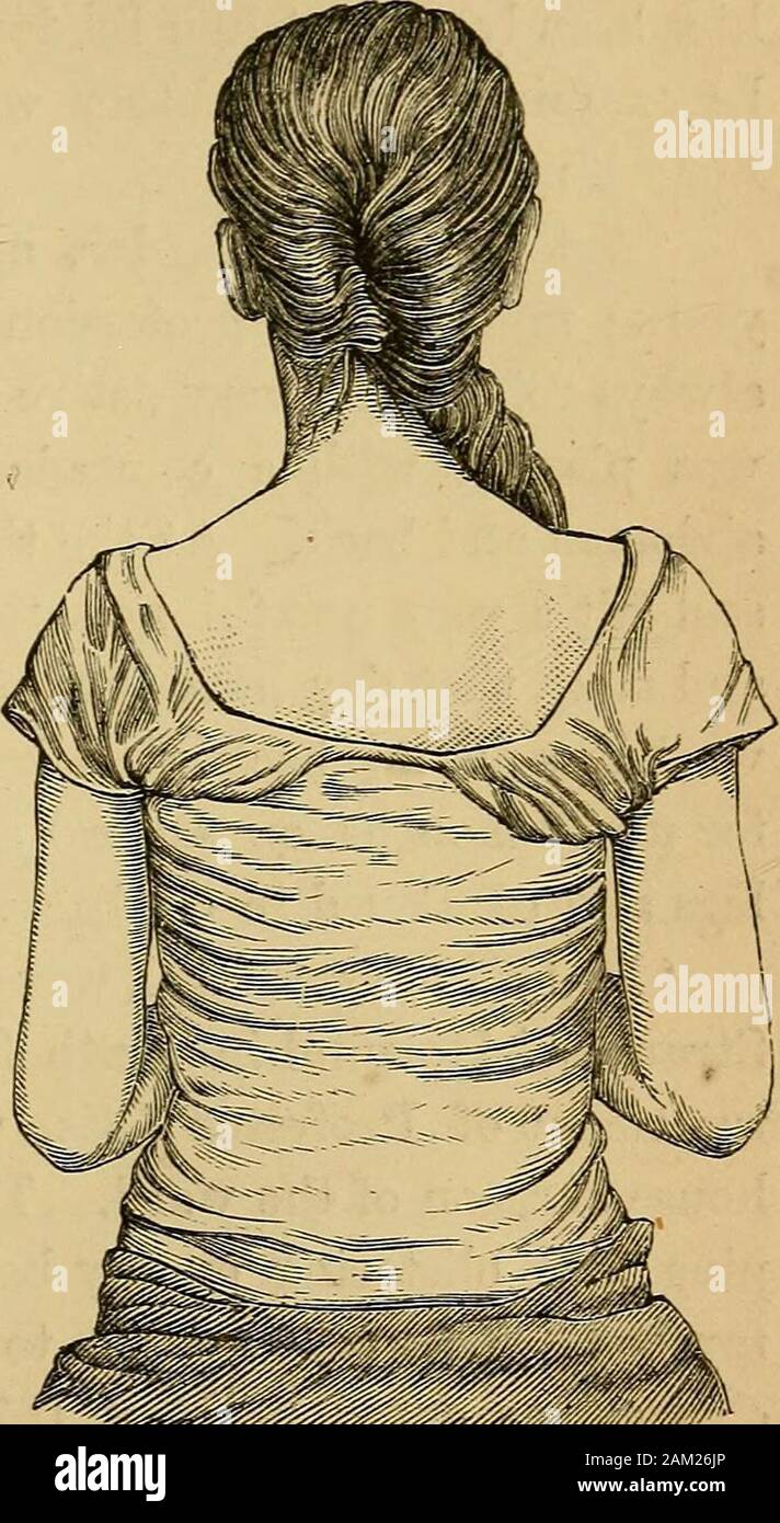 Spinal disease and spinal curvature : their treatment by suspension and the use of the plaster of Paris bandage . fession, calling particular attention to the opinion of Dr. Gibney,who probably examines more cases of Potts disease every yearthan all the other physicians in New York. On May 10, 1876, A. A. Hessler called on me with the fol-lowing note: * My dear Doctor,—This man will tell you his story, and Ifeel sure you will admit him to your wards at Bellevue. * I would wilKngly fuinish him with a brace, but he has notwhere to lay his head. You would prefer plaster of Paris, andconsequently Stock Photo