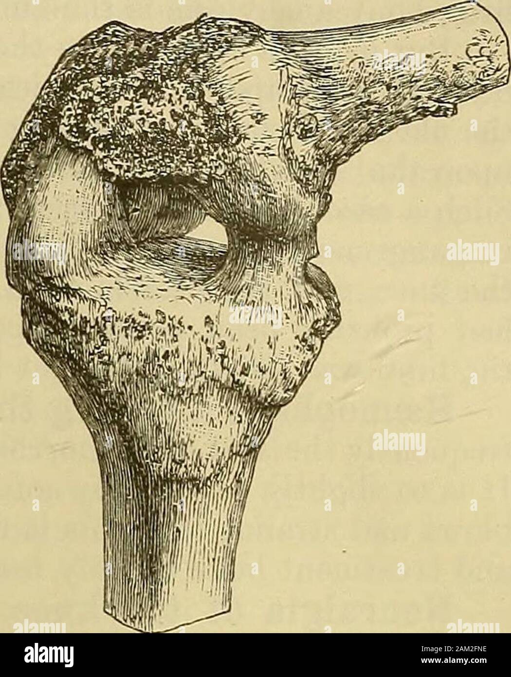 Knee flexion and extension hi-res stock photography and images - Alamy