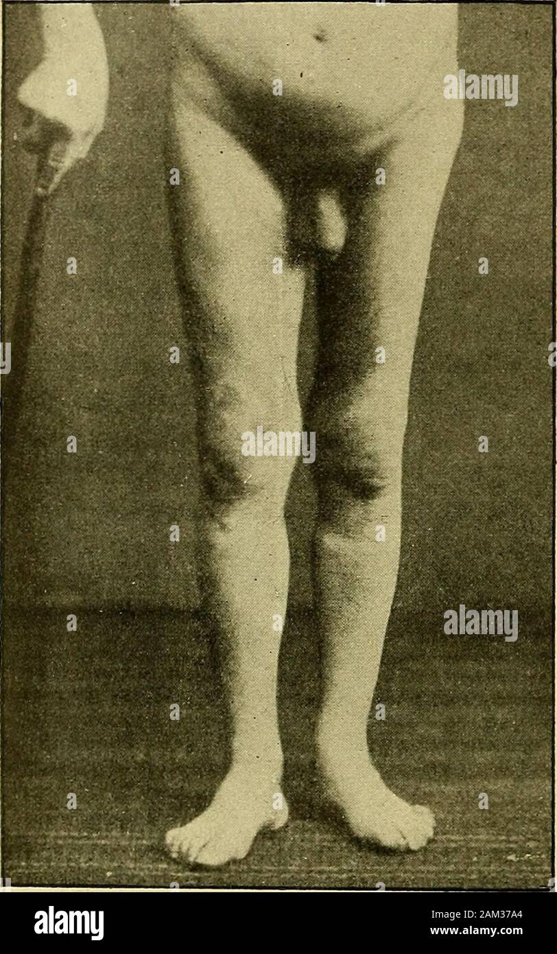 Amyo High Resolution Stock Photography And Images Alamy