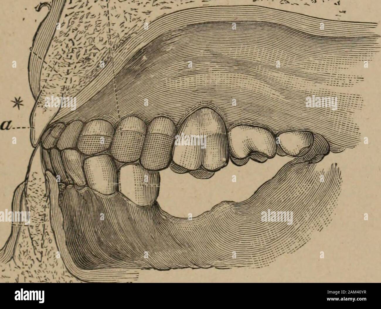 Lectures on operative dental surgery and therapeutics . bserved that the pressure graduallydiminishes from the posterior to the anterior part of themouth, the distribution being more especially upon themolars, decreasing on the bicuspids and canines, while theincisors, in consequence of the superior arch being largerthan the inferior, do not occlude, but are held in closejuxtaposition at such a distance, and so far overlapping,as to endow them with the cutting capacity from whencetheir name is derived. The part taken by the molars insustaining the integrity of the articulation must ever be 161 Stock Photo
