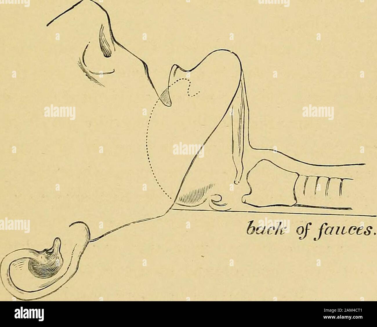 On stertor, apoplexy, and the management of the apoplectic state . Fig. I. — Showing the position of the tongue with the mouth closed.. hach of fauces. Stock Photo