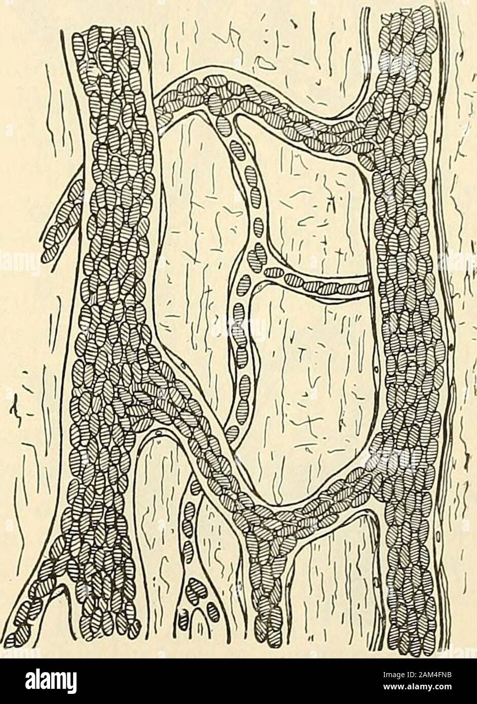 Modern Surgery General And Operative Fig 44 Normal Vessels And Blood Stream Fig 45 Dilatation Of The Vessels In Inflammation Active Hyperemia When An Irritant Is Applied To Tissue There Maybe A Momentary Arterial Contraction