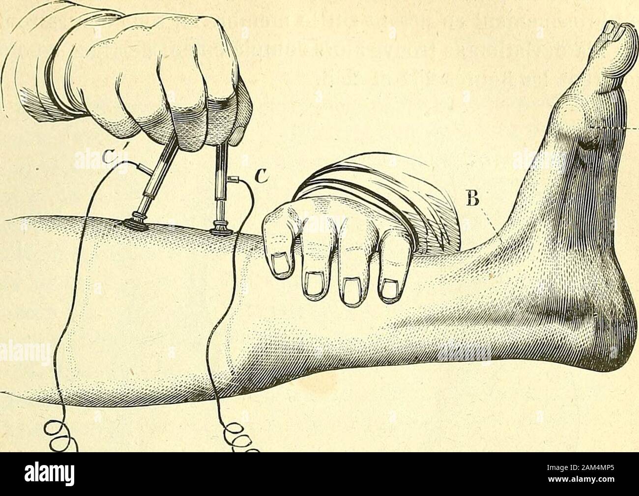 masque chirurgical tii masque chirurgical tii