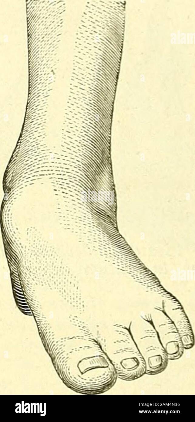 masque chirurgical tii masque chirurgical tii