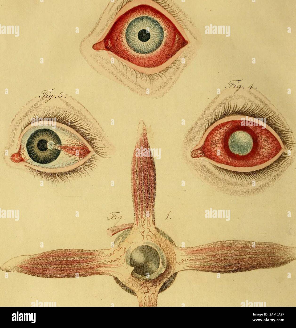 A synopsis of the diseases of the eye, and their treatment : to which are prefixed, a short anatomical description and a sketch of the physiology of that organ . he lens; the posterior part of the zonulafrom the arteria centralis after its division upon the posteriorcapsule of the crystalline lens, and forming here an anasto-mosis with the other vessels ; and finally, the zonula has been APPENDIX. injected with the capsule, but the hyaloid membrane has notshewn the least trace of injection. Lens crystallina, is included in a proper capsule ; the an-terior is firmer than the posterior, which de Stock Photo