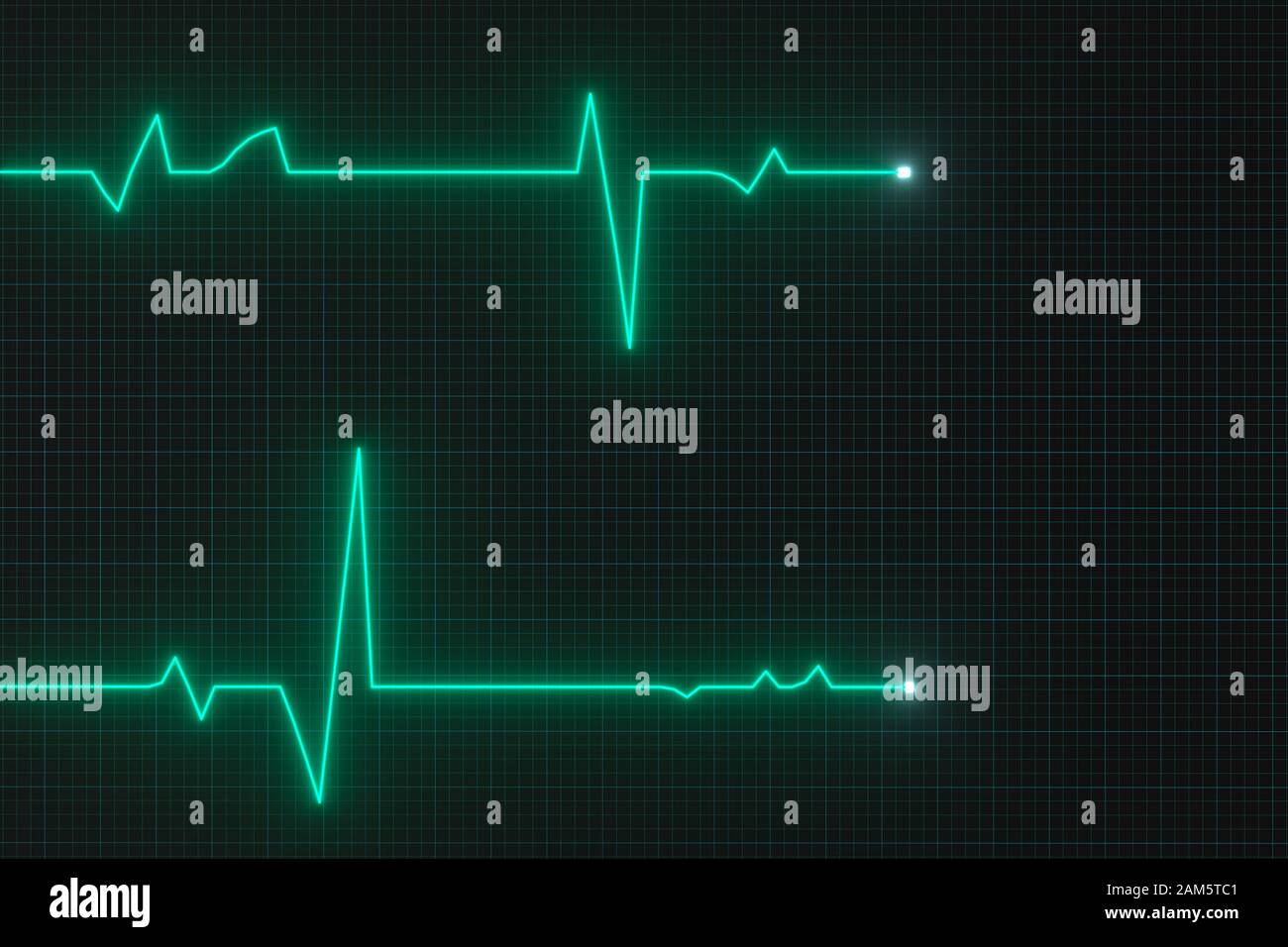 Medical background green ecg line hi-res stock photography and images - Page 2 - Alamy Medical background green ecg line hi-res stock photography and images - Page 2 - Alamy