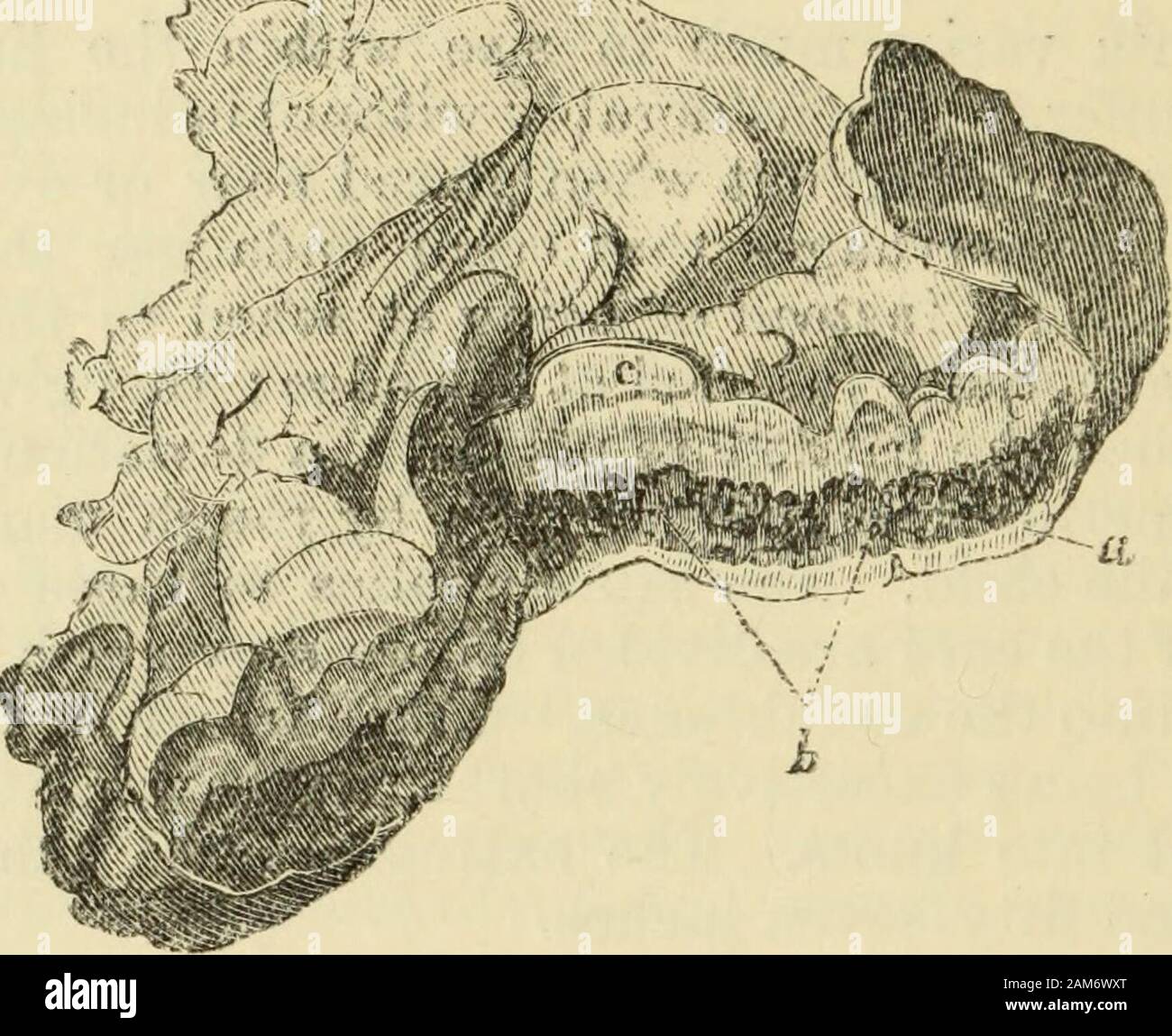 Manual of pathological anatomy . and, some-times, almost livid colour, the internal structure presenting a deeppurple hue, from the vessels being overcharged with blood, whilethe substance is heavier and more solid than natural. One of thesequelae of congestion is haemorrhage into the body, or on thesurface of the placenta, varying much in extent. The efiusedblood undergoes the changes usually traced in coagula, and whenthere are several fibrinous remains, they cause a tuberculatedappearance. * * Edinburgh Medical and Surgical Jouraal, vol. xv. p. 265. 798 THE PLACENTA. Inflammation of the pla Stock Photo