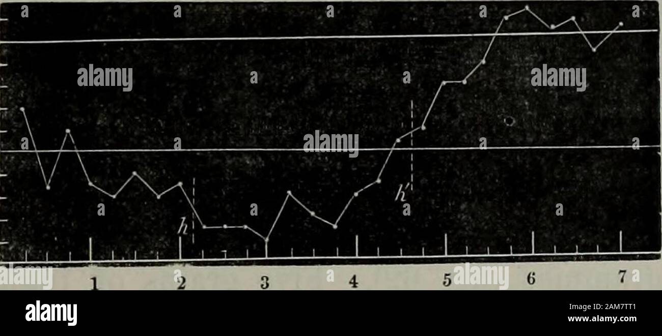 Transactions of the Royal Society of Edinburgh . Fig. 60.—Secretion of bile before and after hydrastin andsodium salicylate. 2 grains of hydrastin in 2 cc. ofrectified spirit, 1 cc. of bile, and 2 cc. of water in-jected into the duodenum at h and h! 20 grains ofsodium salicylate in 10 cc, of water injected into thelower portion of the intestine at s.. Fig. 61.—Secretion of bile before and after hydrastin. 2 grains ofhydrastin in 2 cc. of bile, 1 cc. of rectified spirit, and 6 cc. ofwater injected into the duodenum at h and ti. Necropsy.—Slightly increased redness of duodenal mucous membrane.V Stock Photo