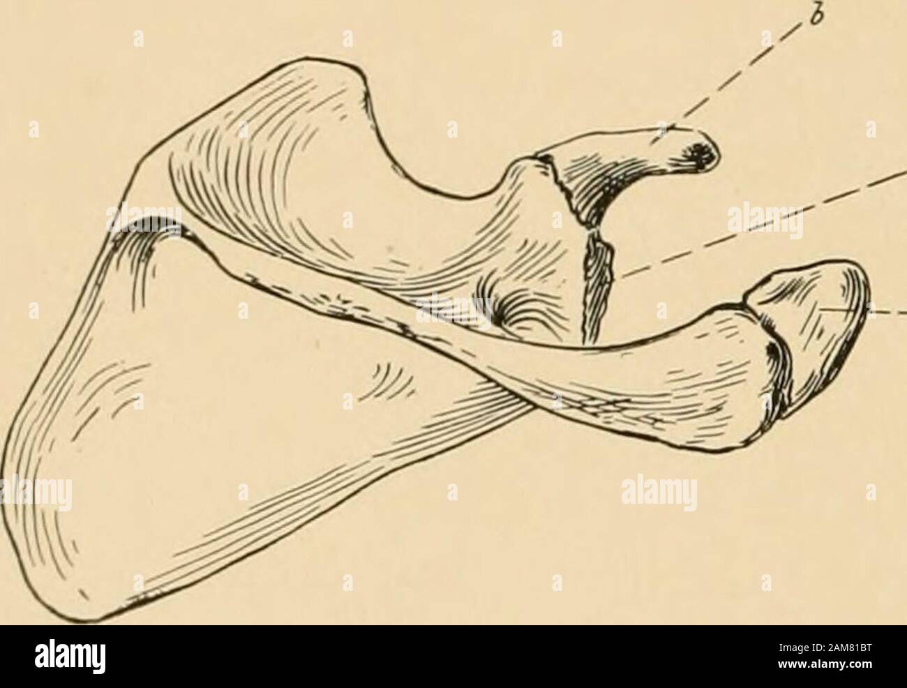 The treatment of fractures . ysis for the internal epicondyle forms no