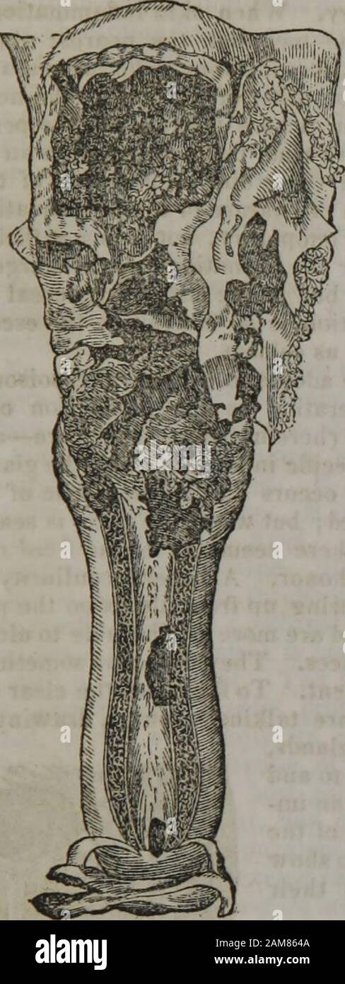 Porneiopathology : a popular treatise on venereal and other diseases of the male and female genital system : with remarks on impotence, onanism, sterility, piles, and gravel, and prescriptions for their treatment . ON VENEREAL DISEASES. 93. Stock Photo