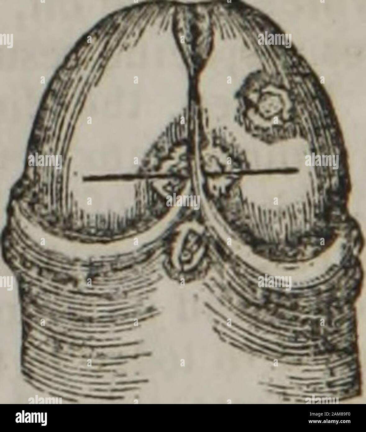 Porneiopathology : a popular treatise on venereal and other diseases of the male and female genital system : with remarks on impotence, onanism, sterility, piles, and gravel, and prescriptions for their treatment . ON VENEREAL DISEASES. Stock Photo