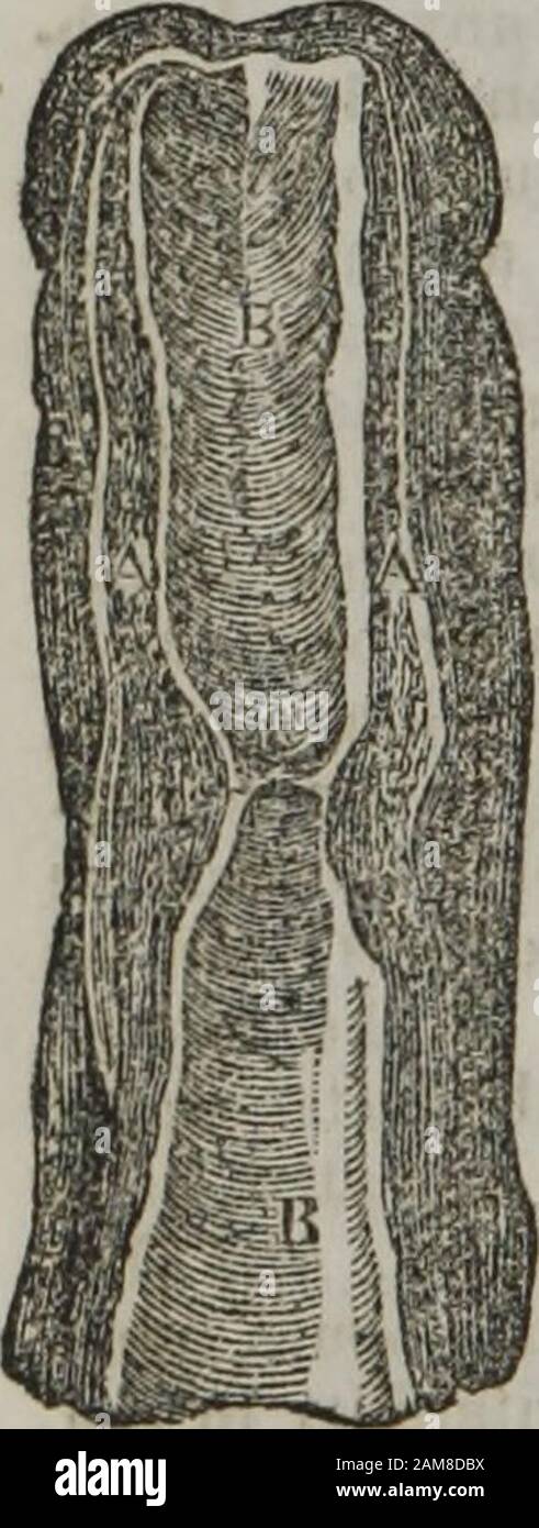 Porneiopathology : a popular treatise on venereal and other diseases of the male and female genital system : with remarks on impotence, onanism, sterility, piles, and gravel, and prescriptions for their treatment . lt to explain the process; but lymphis that fluid understood to be the nutritious portion of oursustenance or system, and which is here yielded up by thevessels which absorb it, and which vessels abound, withfew exceptions, in every tissue of our body. However, itwill suffice to say, that where inflammation takes place,there is an alteration of structure, and that alteration isgener Stock Photo