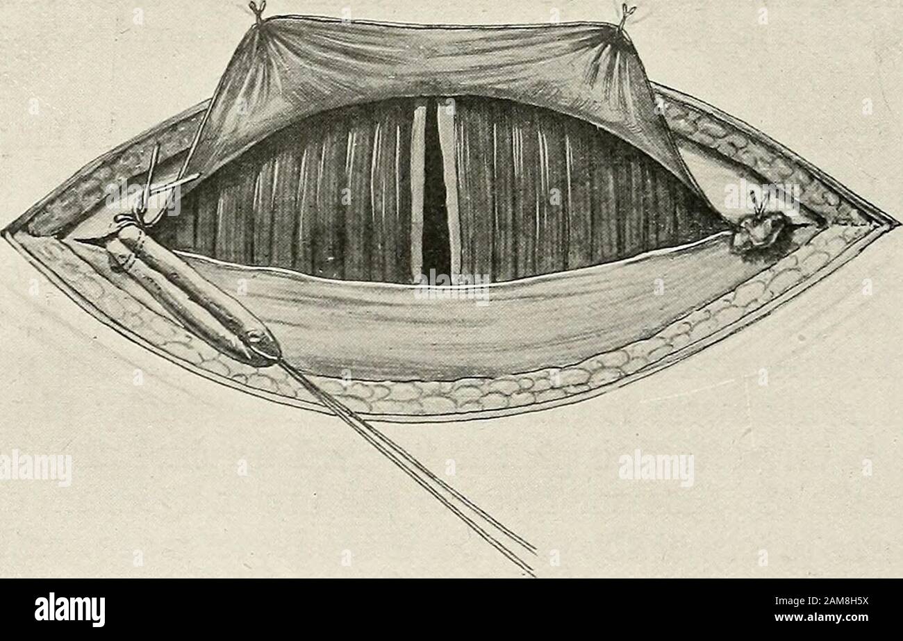 Ligature point hires stock photography and images Alamy