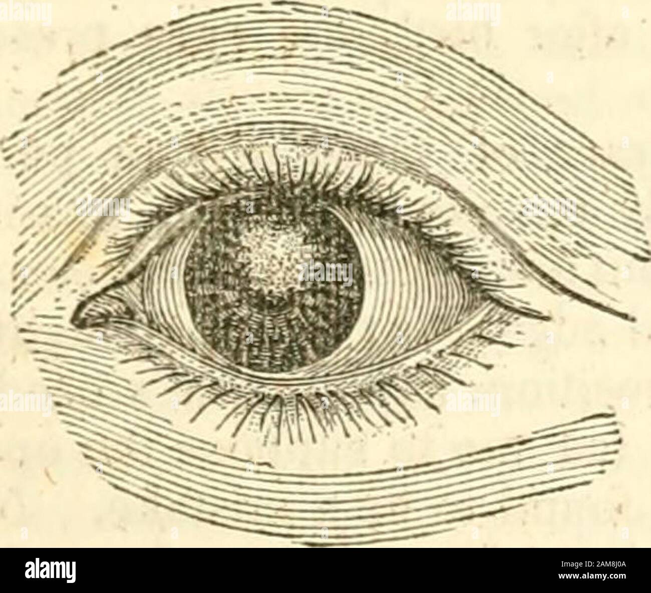A treatise on the diseases of the eye . is the firm whiteshining