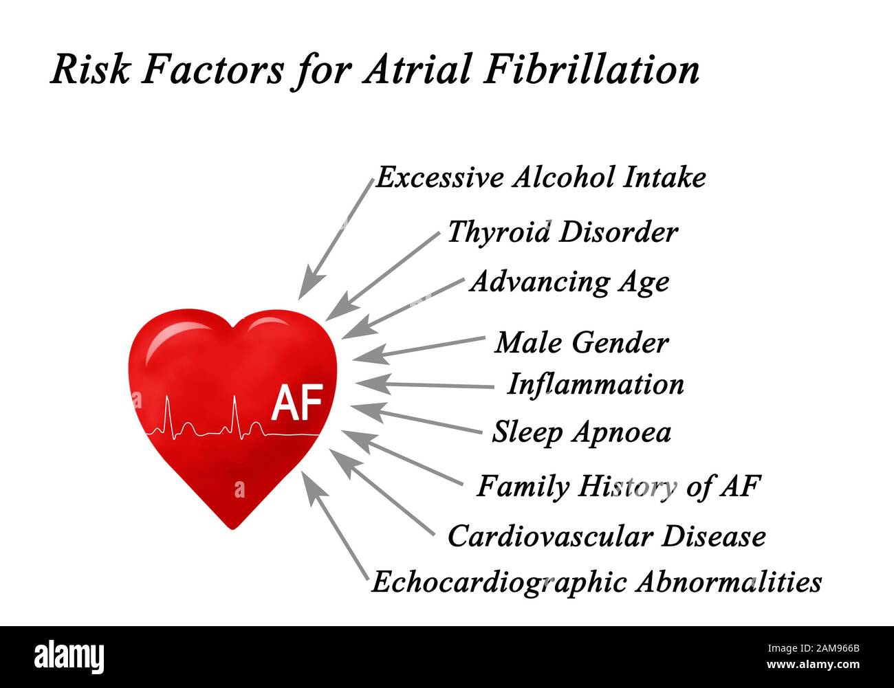 Risk Factors for Atrial Fibrillation Stock Photo Alamy