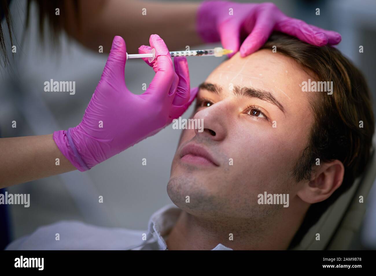 Young man having his forehead wrinkles reduced with inserted muscle movement inhibitor substance Stock Photo