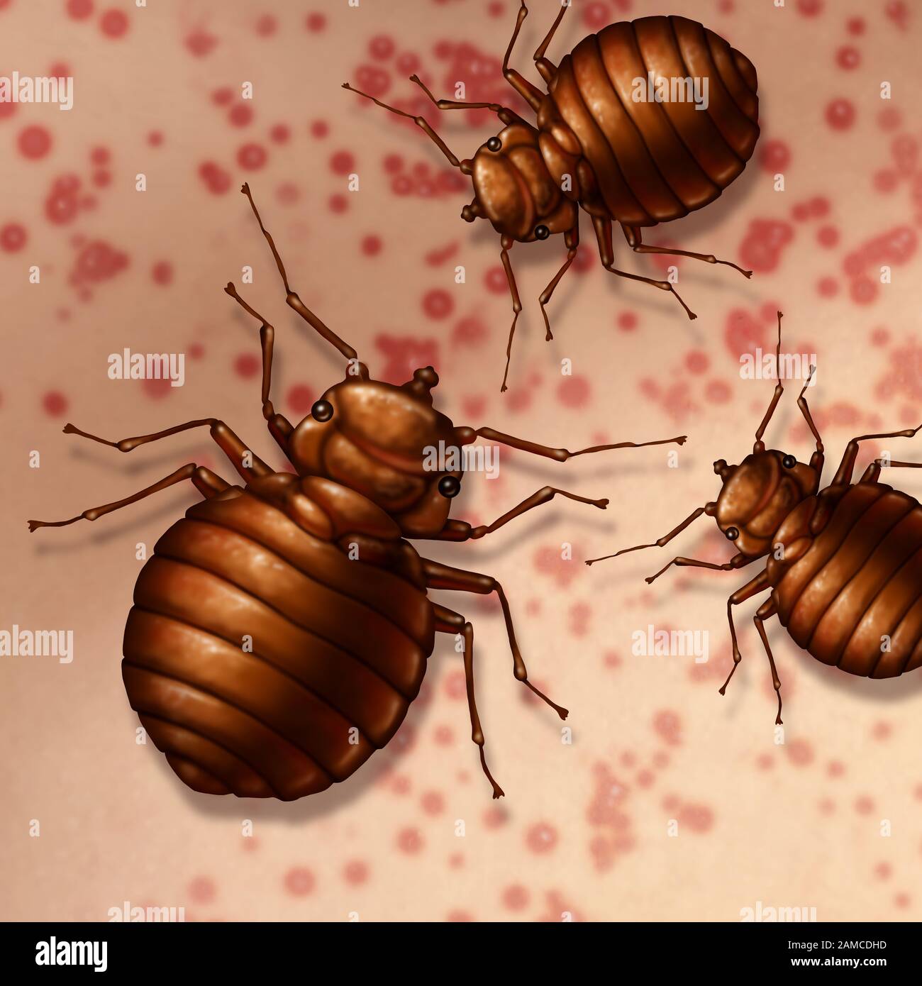 Bed bug on skin as bedbugs bites on the human body or bedbug infestation concept as a close up of  parasitic insect pests as a hygiene symbol. Stock Photo