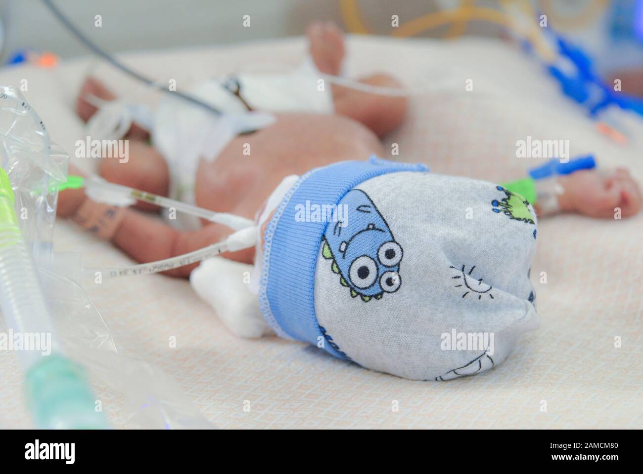 Newborn with ventilatory support and venous access, in intensive care unit,  at chidren's hospital.  Guayaquil.  Ecuador Stock Photo