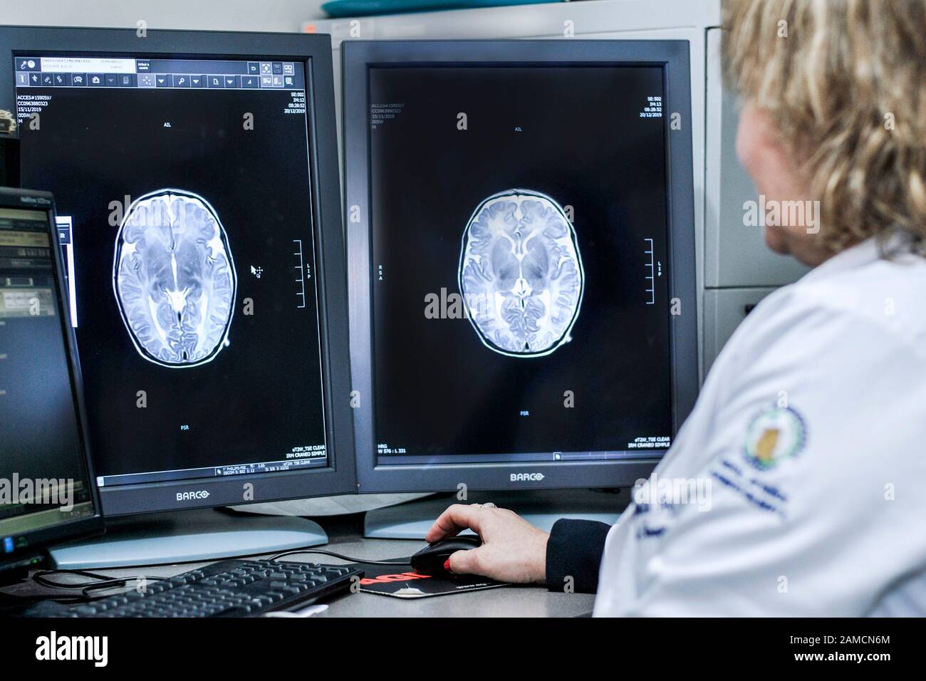 Doctor looking at resonance images.  Pediatric Hospital. Guayaquil.  Ecuador Stock Photo