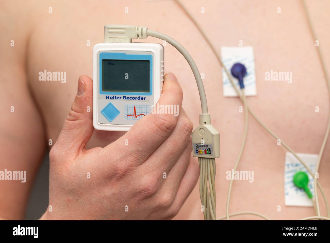 Young man with  heart diseases wearing holter monitor device for an electrocardiogram Stock Photo