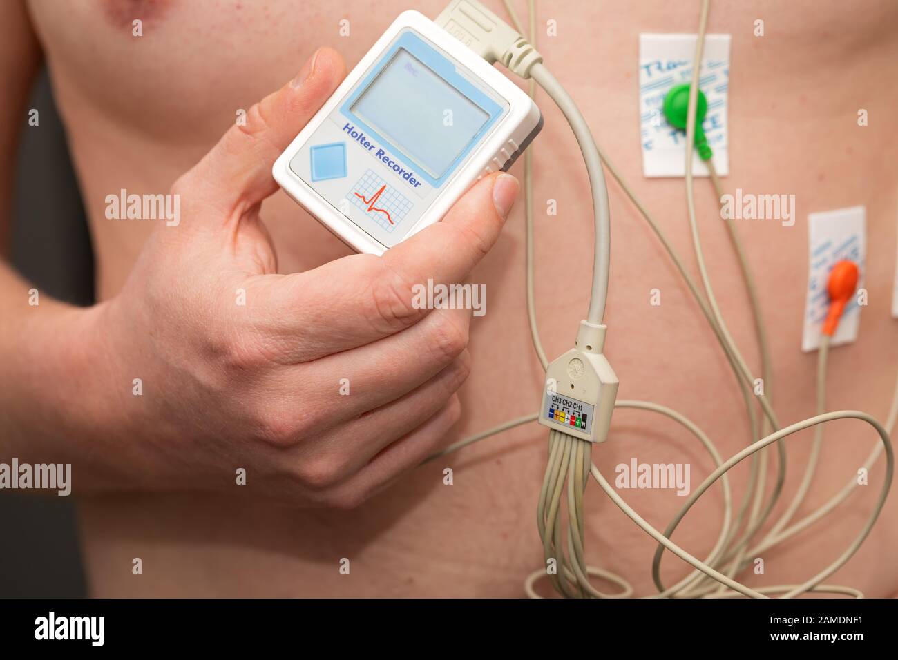 Young man with  heart diseases wearing holter monitor device for an electrocardiogram Stock Photo