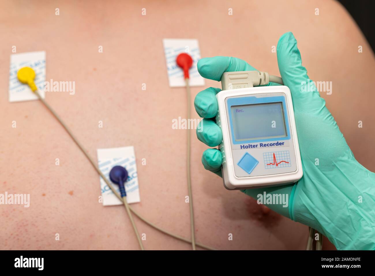 Doctor's hand applying holter heart monitor on young man's chest Stock Photo
