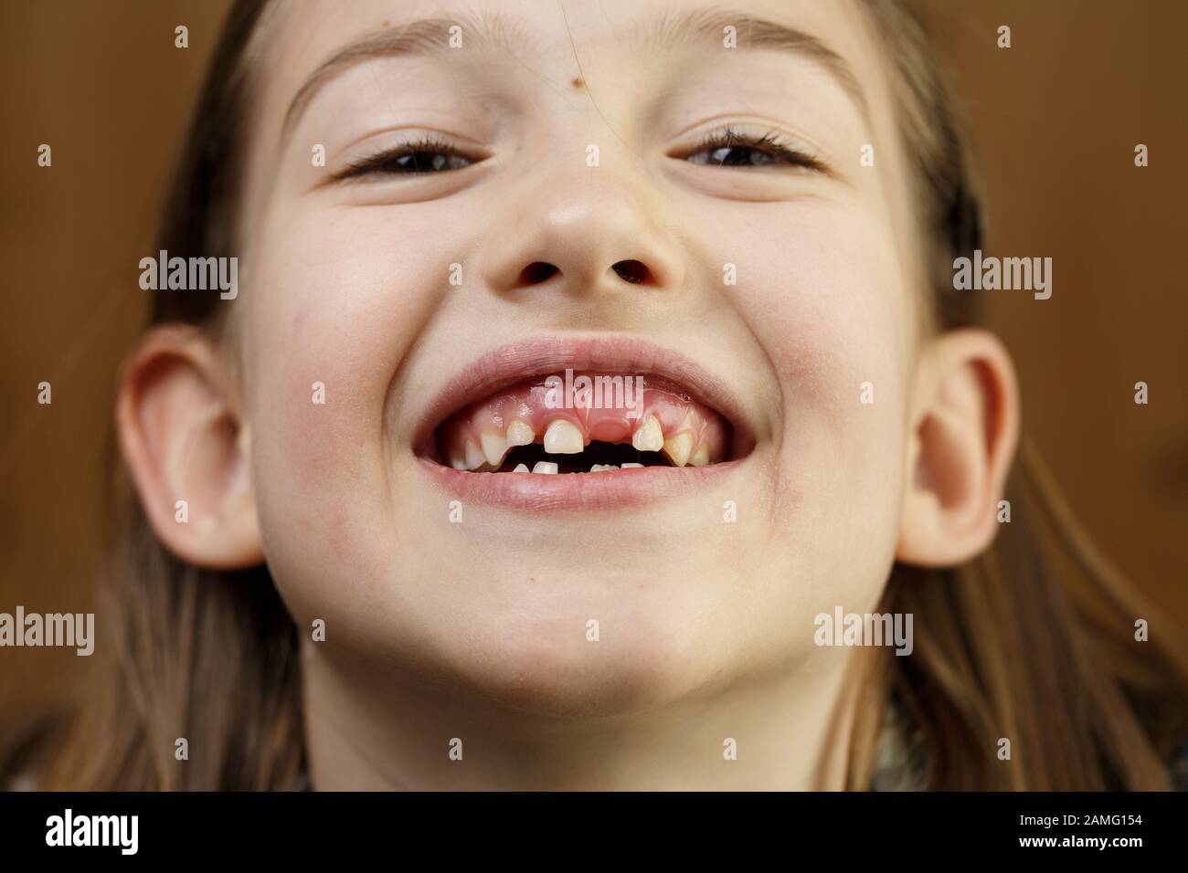 Little girl making faces, smiling, showing her loose and missing milk teeth. Playful, cheerful childhood, tooth fairy, growth and milestone concept. Stock Photo