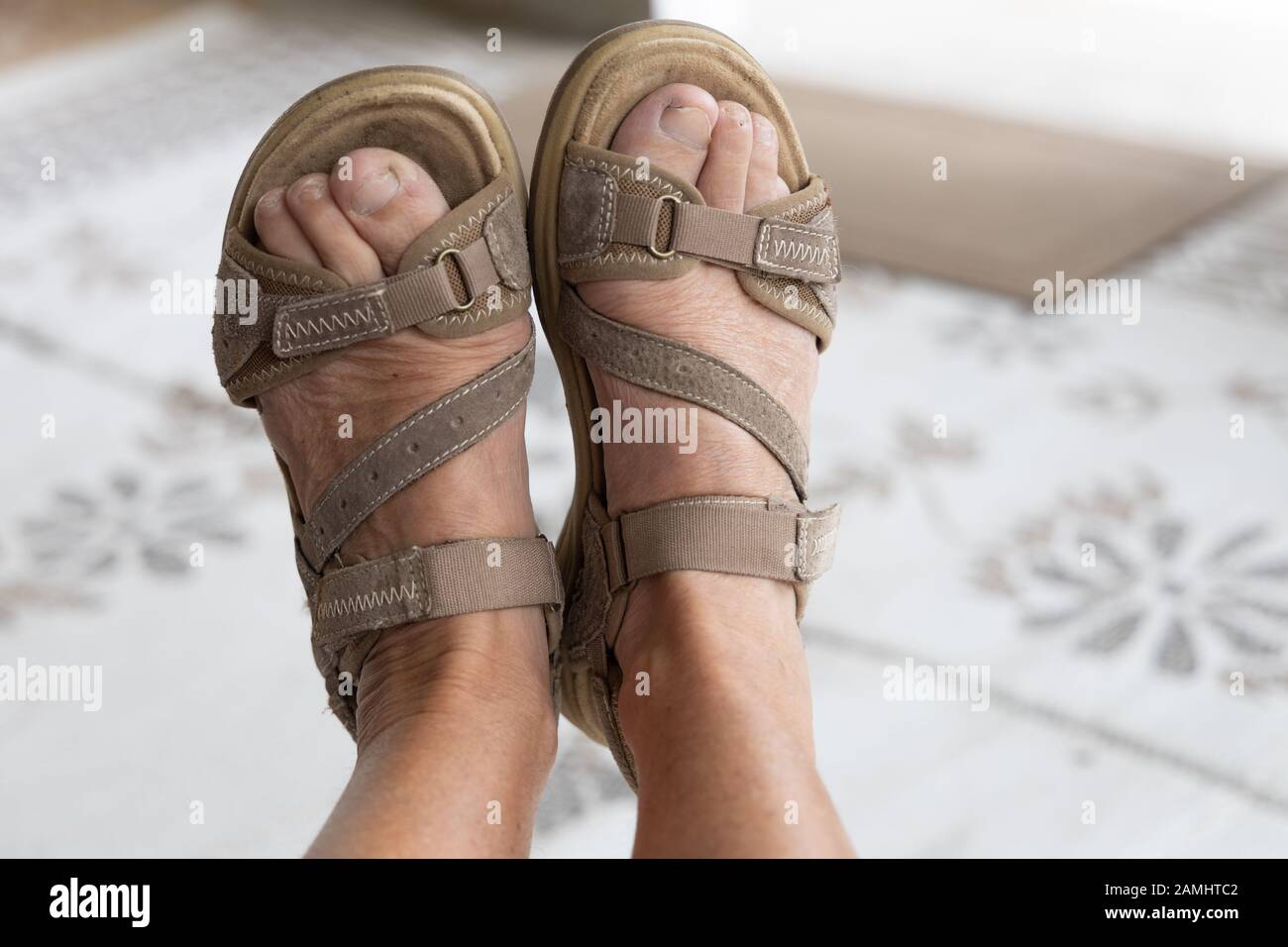 Close of woman's ugly feet wearing open toed sandals Stock Photo