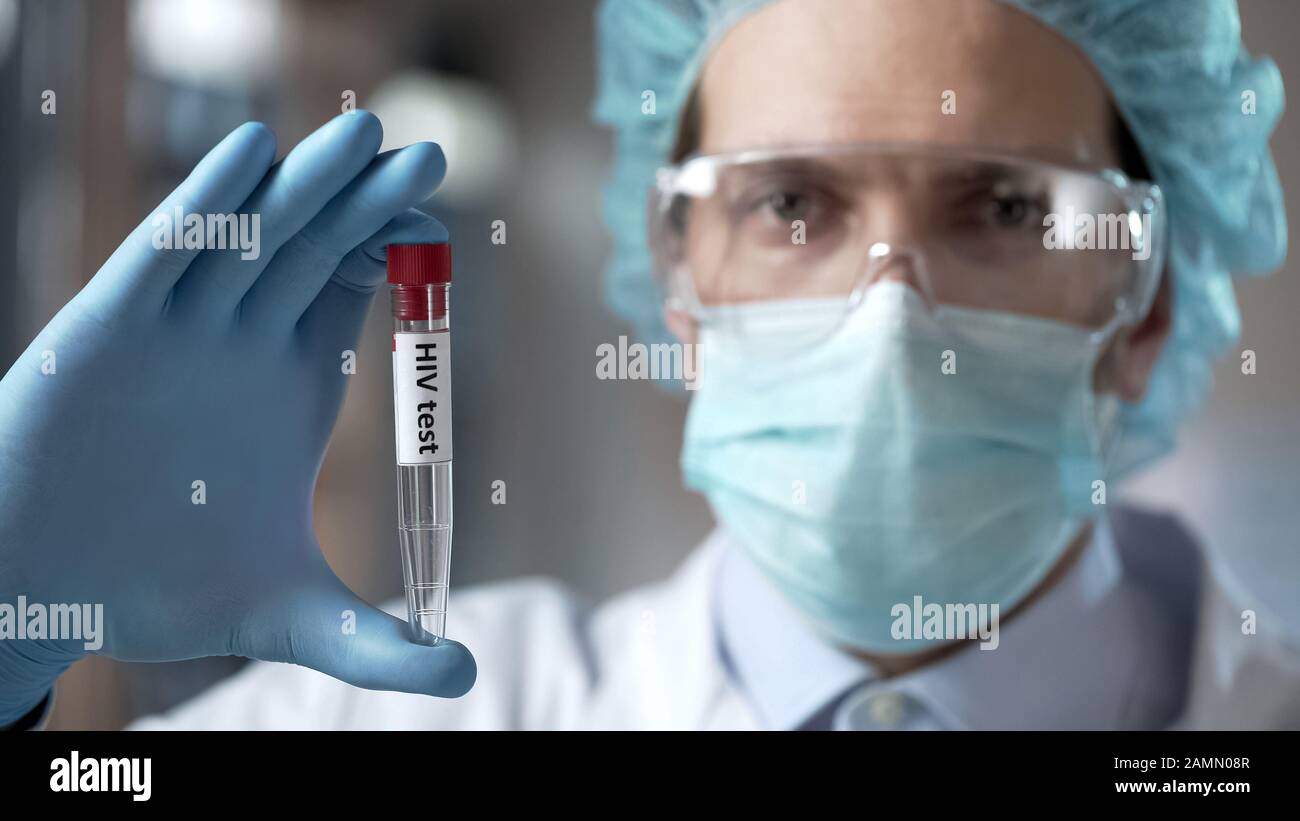 Laboratory expert holding blood test for HIV antibodies, infection