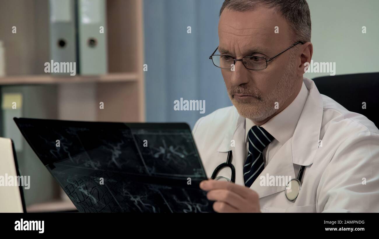 Doctor examining venogram, blockage of blood vessels, risk of heart attack Stock Photo
