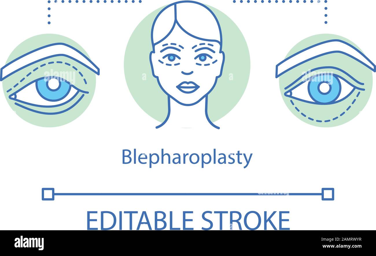 Blepharoplasty concept icon. Eyelid surgery idea thin line illustration.  Eyelid surgical repair. Cosmetic surgery. Eyelids deformities. Vector  isolate Stock Vector Image & Art - Alamy