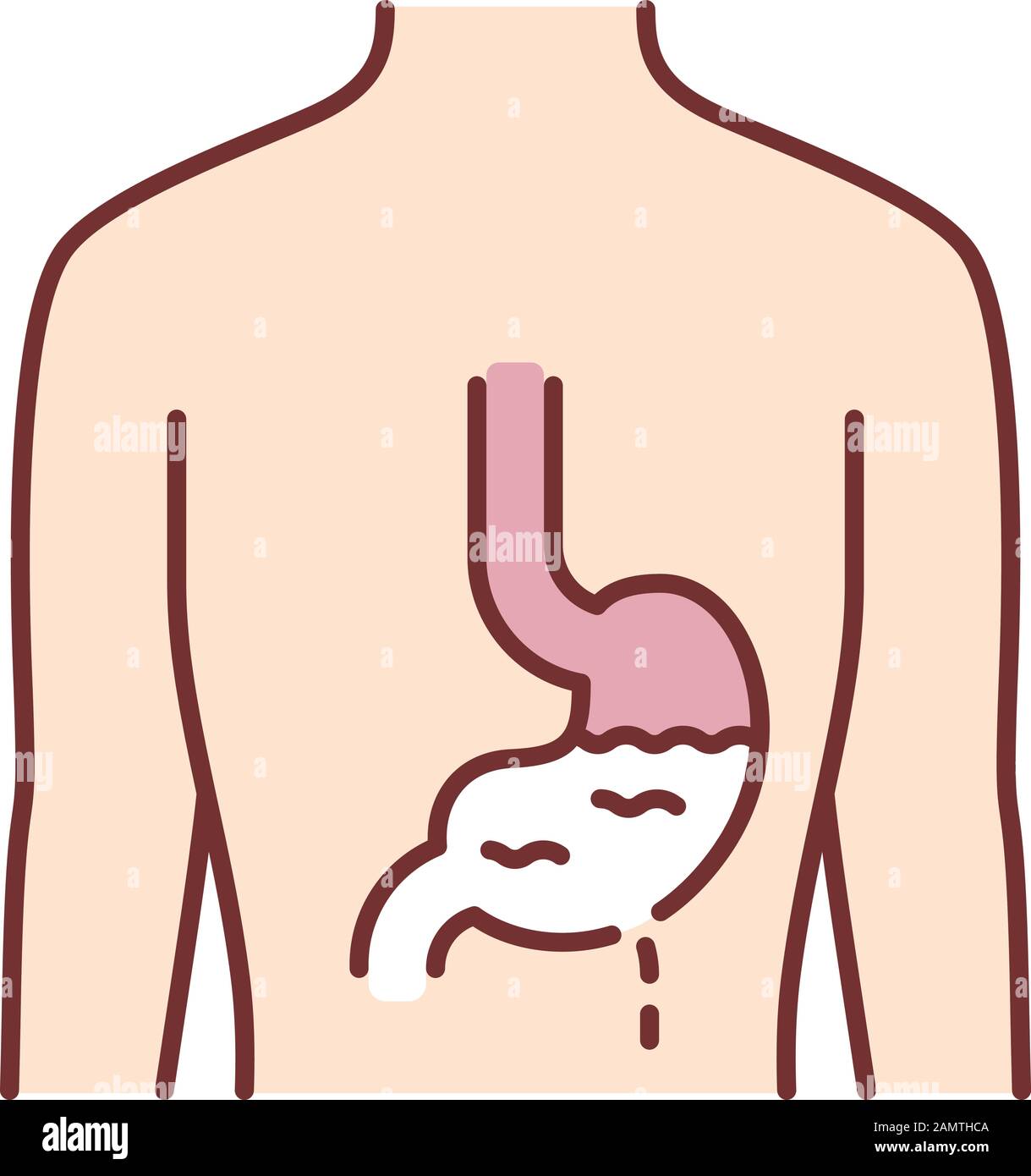 Ill stomach color icon. Gastritis. Sore human organ. People disease. Unhealthy digestive system. Sick internal body part. Gastrointestinal tract. Isol Stock Vector