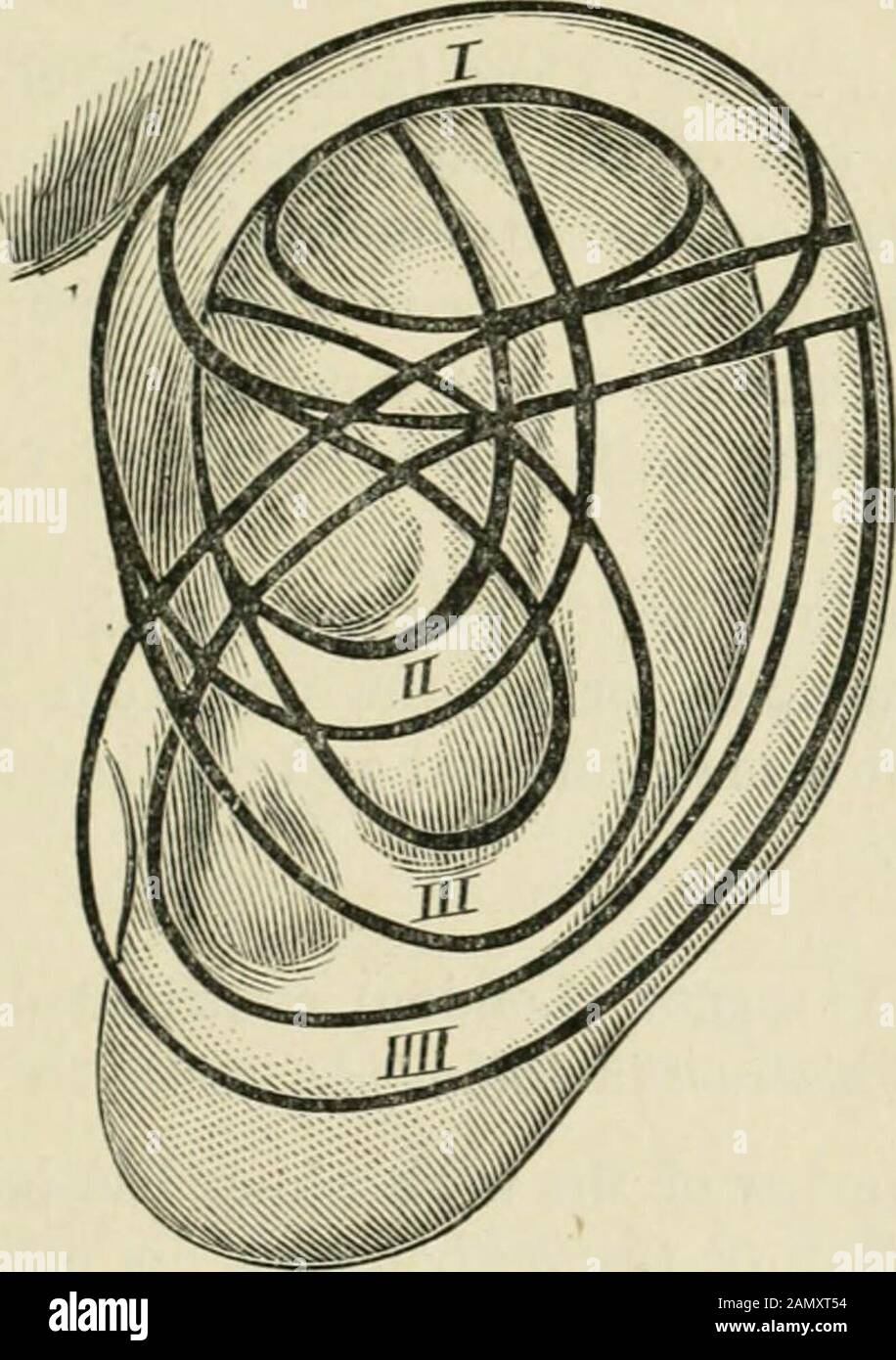 The Journal of laryngology and otology . anterior and inferior part of the auricle; to thesecondary, the posterior-superior part, with helix horizontalis anddescendens, cauda helicis, truncus of the anthelix and crus superiusanthelicis. The axis of the ear going from the incisura trago-helicina tothe tuberculum Darwinii, the real ear-point, gives the coefficient November, 1899.] Rhinology, and Otology. 609 for the powers of secondary folding of the auricle by traction andcompression, parallel or vertically, to the axis. Therefore, in thedeveloped external ear, we find the normal model, and exc Stock Photo
