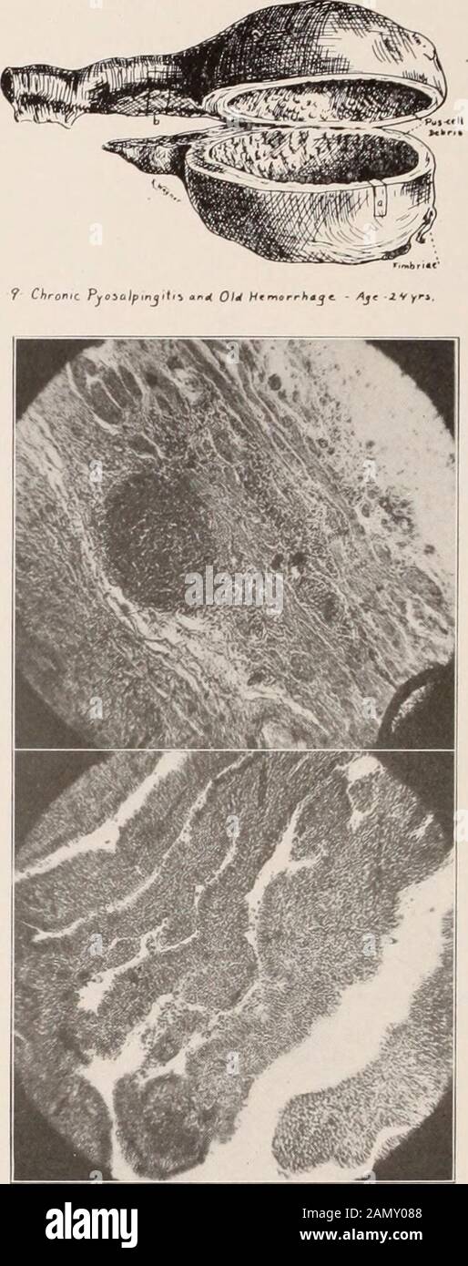 Transactions of the American Association of Obstetricians and ...