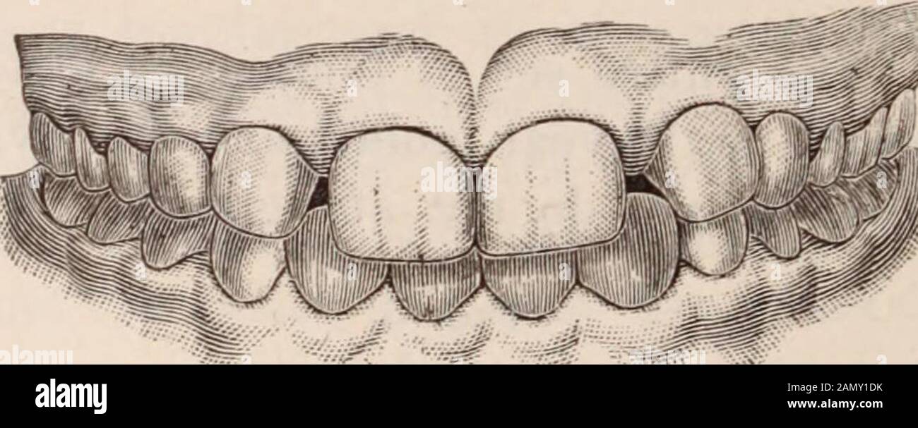 Lower cuspids lower teeth hires stock photography and images Alamy