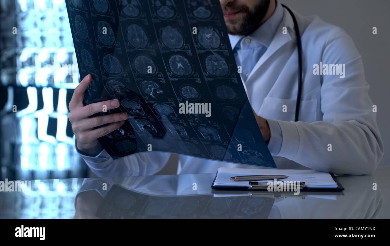Oncologist examining brain x-ray in laboratory, cancer treatment, health care Stock Photo