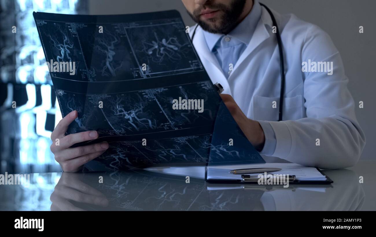 Serious neurosurgeon looking at cerebral vessels x-ray, health care diagnostics Stock Photo