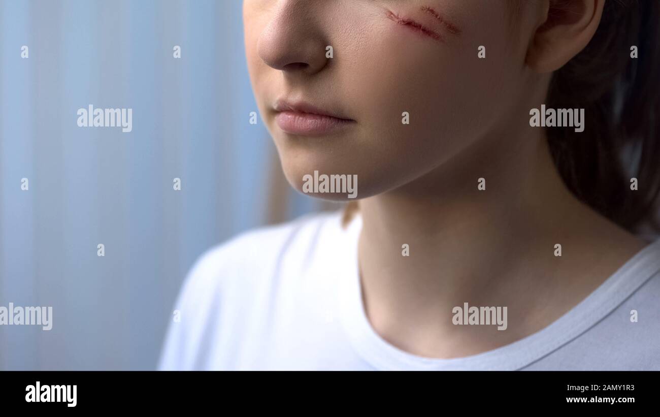 Physician handling wound on female face, scars and treatment after