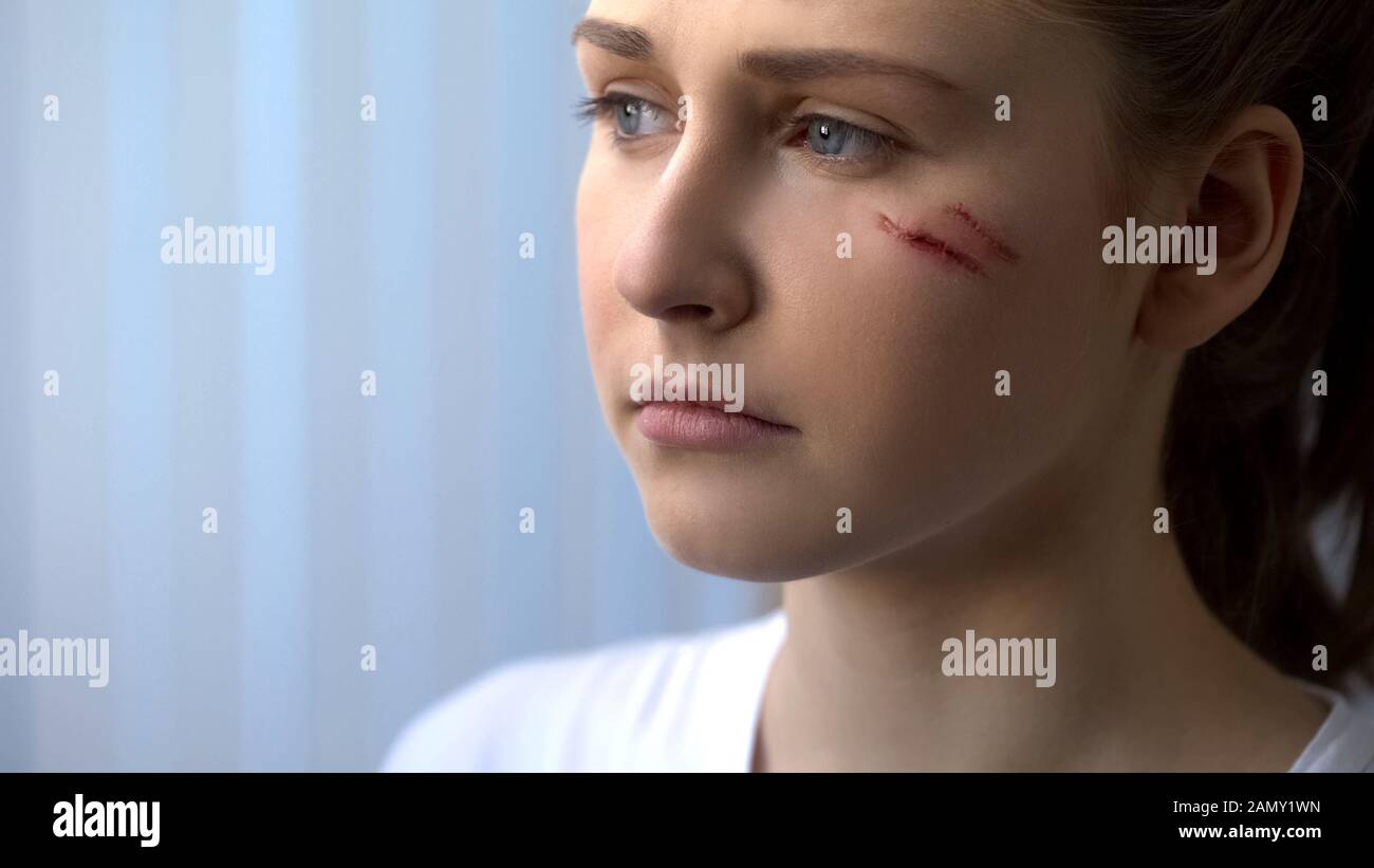 Scars healing hires stock photography and images Alamy