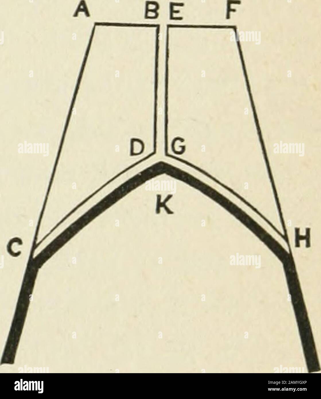 Annals Of Surgery Udinal In Cision Which Is Bisected And A Perpendicular Incision Is Drawn Down Ward From The Point Of Bisection Nearly Asfar As Where The Nasal Bones Join On Thecartilage Of