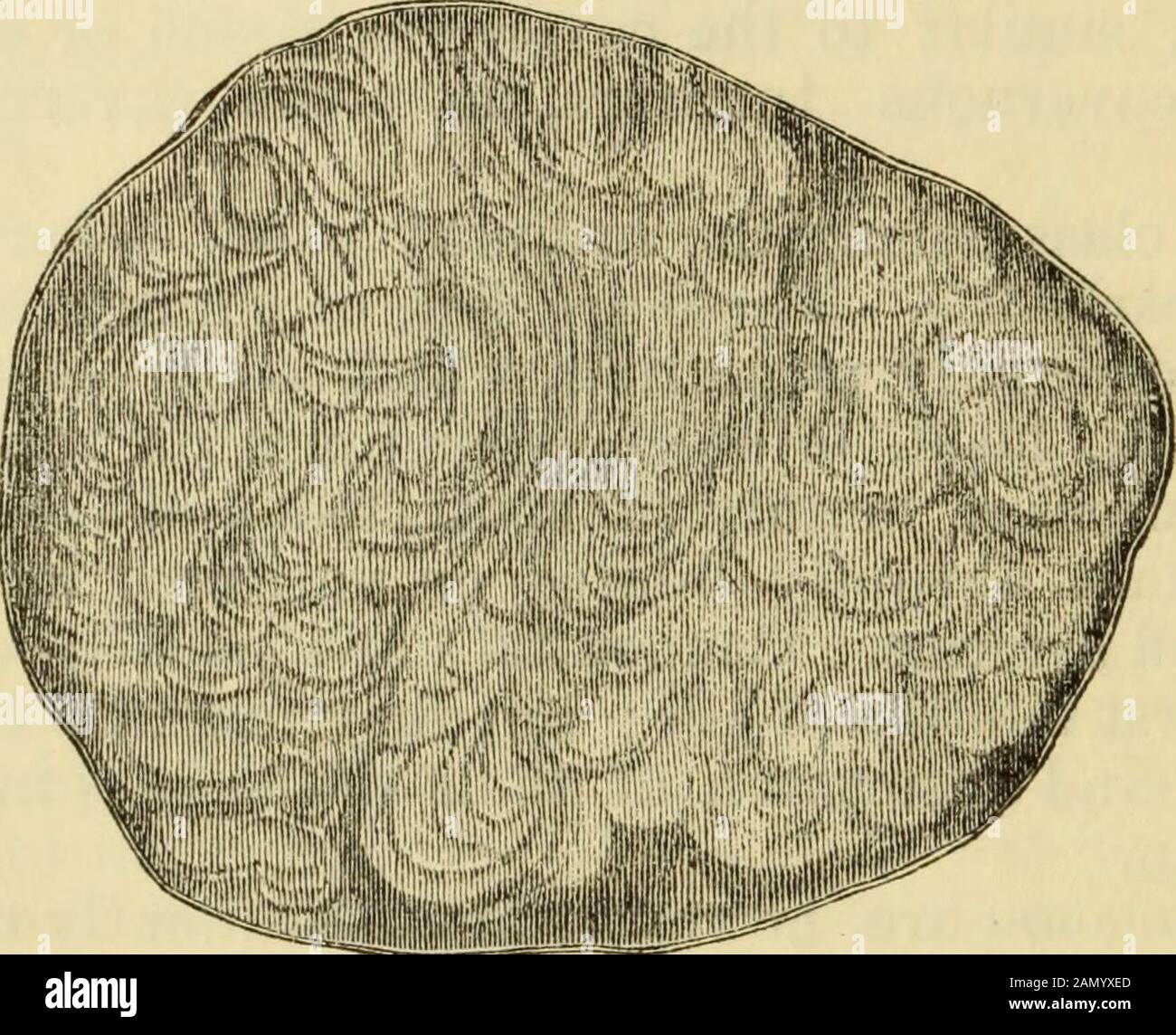 Manual of pathological anatomy . often inseparable from the surroundingtissue. External cavernous tumours occur either in the skin orin the subcutaneous fatty tissue. Of internal organs they occurmost frequently in the liver, where, however, they are by nomeans common. They have also been observed in the spleen,kidneys, suprarenal capsules, intestines, uterus, and ovaries, andon the inner surface of the bladder, and are sometimes multiple.*It is only in the rarest instances that they lead to haemorrhage orany serious affection, and they are strictly innocent in their charac-ter. It is probable Stock Photo