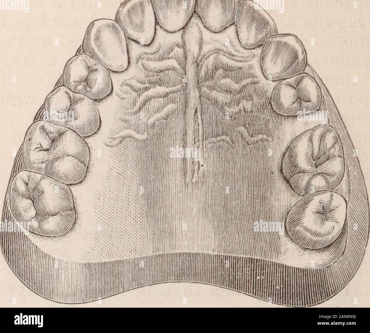 Dental cosmos . ruga,but to a less degree. The post-sutural rugae ...