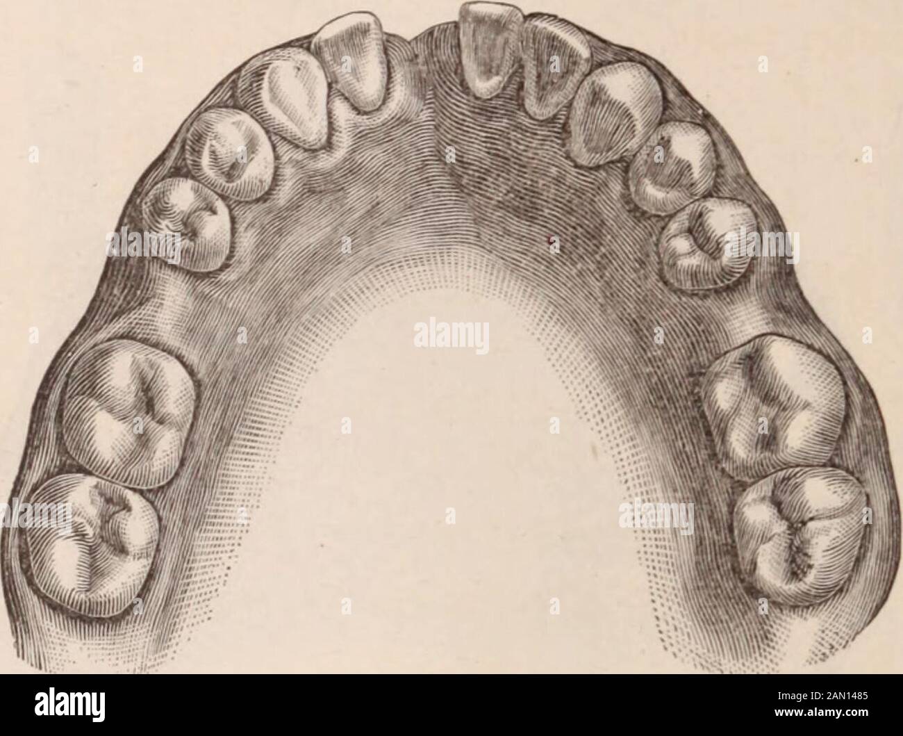 Dental cosmos . 30 THE DENTAL COSMOS. were missing, the cuspids had ...