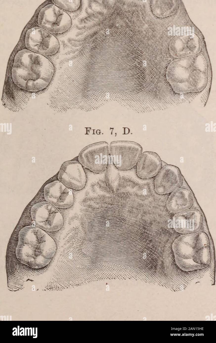 Dental cosmos . Fig. 7, C.. 30 THE DENTAL COSMOS. were missing, the cuspids had come forward, and the bite was soclose that regulation was impracticable, and at best would have neces-sitated a plate for the laterals. The cuspids were removed, theirsockets brought forward, and selected laterals implanted. The cus-pids were afterward placed in new sockets, and the result is as Fig. 8, E. Stock Photo