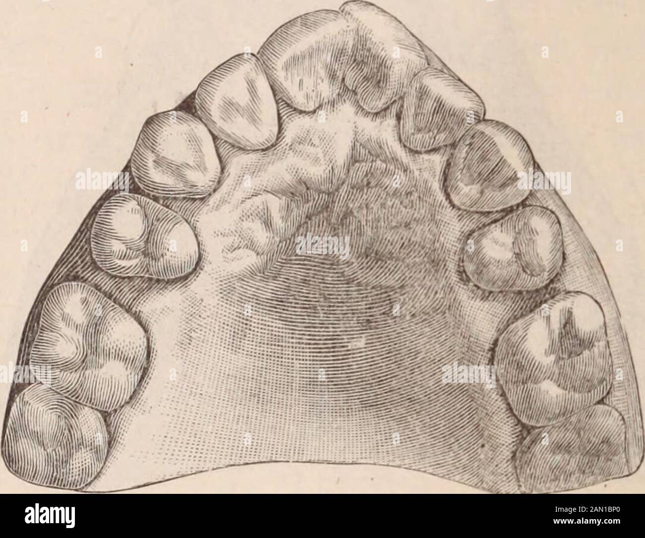 Dental Cosmos To Receive The Key Stone The Cuspid Tooth It Moves Slowly Downuntil It Meets A Resistance So Great That The Anterior Dental Arch Andalveolar Process Are Not Strong Enough To