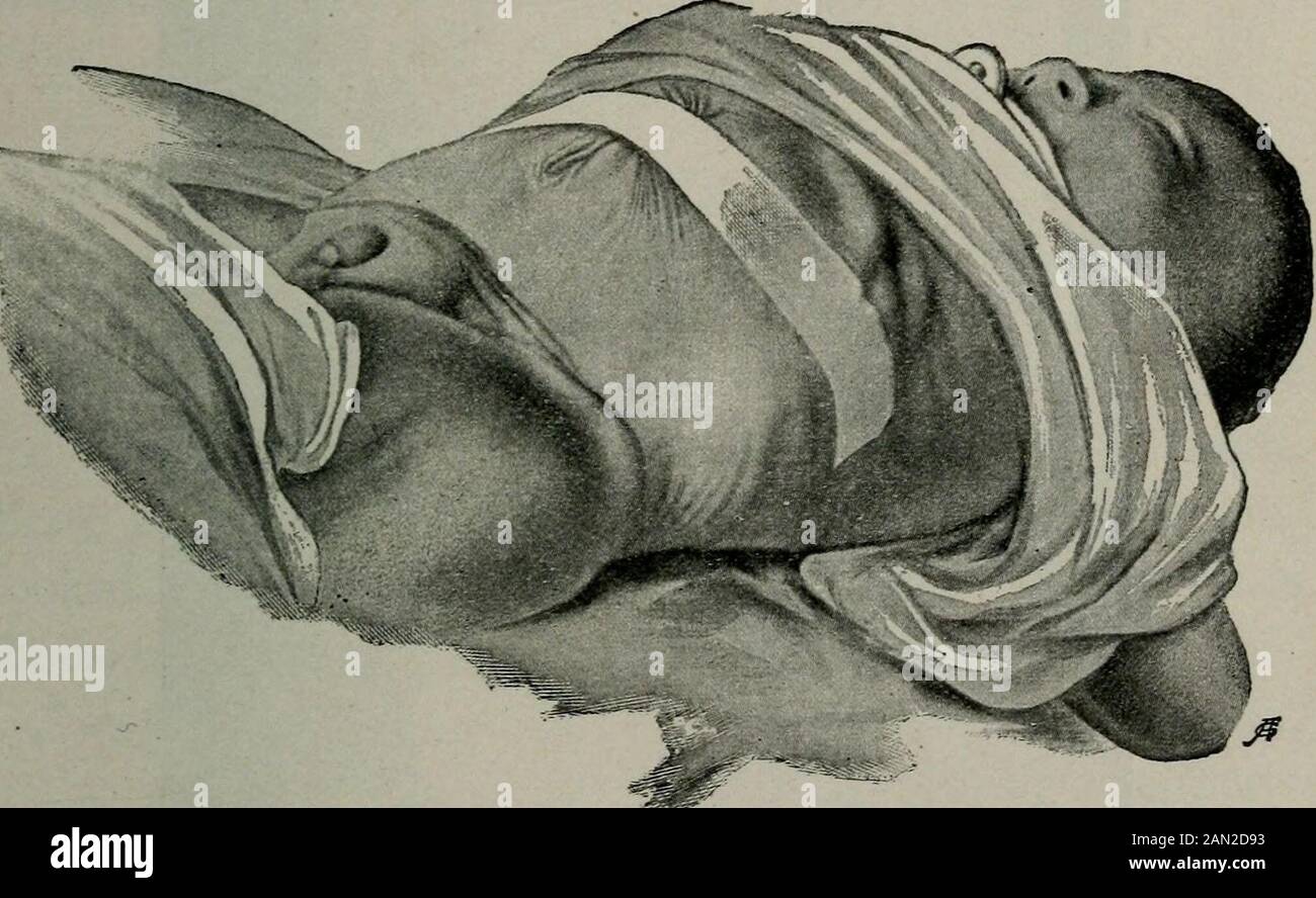 Nurse Has Enema Bag Nurse Has Enema Bag