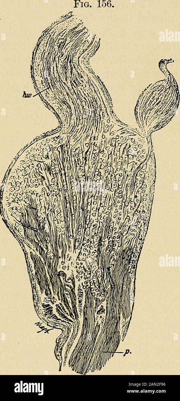 Organic and functional nervous diseases; a text-book of neurology . gree ofinterstitial inflammation has beenfound there. Whether this inflam-mation is the primary cause of thedegeneration of the sensory neur-ones which lie in the ganglia is notyet determined. While the lesion in tabes islimited to the sensory neurones ofthe nervous system, it must beadmitted that no satisfactory theoryof its pathogenesis exists. It isnot yet known why the lesion ismanifest in the central axone of the sensory neurone, and yet is insome cases wanting in the neurone body and in the peripheral axone.Etiology. — T Stock Photo