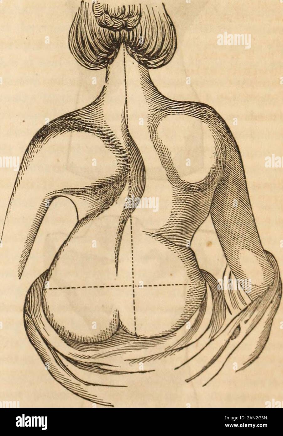 The Medical and surgical reporter . Fig. 69, shows the appearances of the preced-ing diagrams, but more extended. The anato-mical character we have brouglit under your no-tice under the pathological head to which werefer you. i8 COMMUNICATIONS. [Vol. X. Fig. 70. Stock Photo